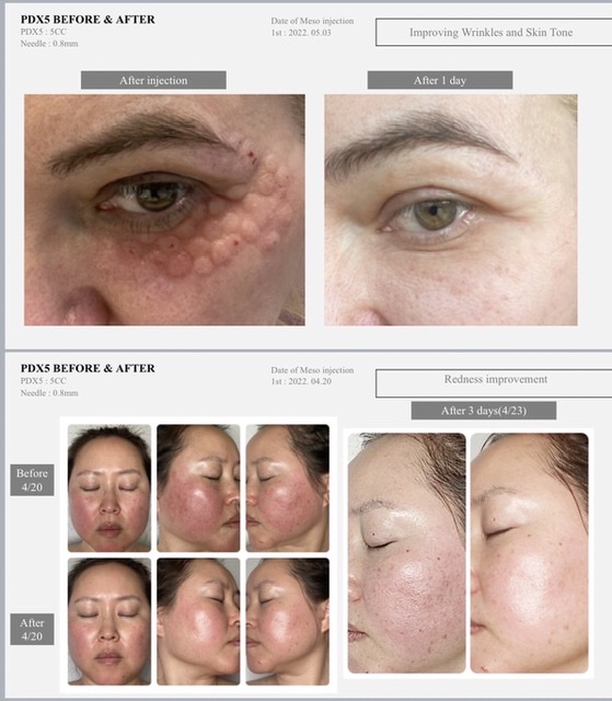 รูปภาพที่4 ของสินค้า : PDX ( Skinbooster Complex )